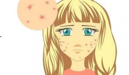 疙瘩吃瓜直播间,揭秘娱乐圈幕后故事